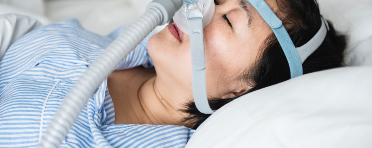 Sleep Apnea